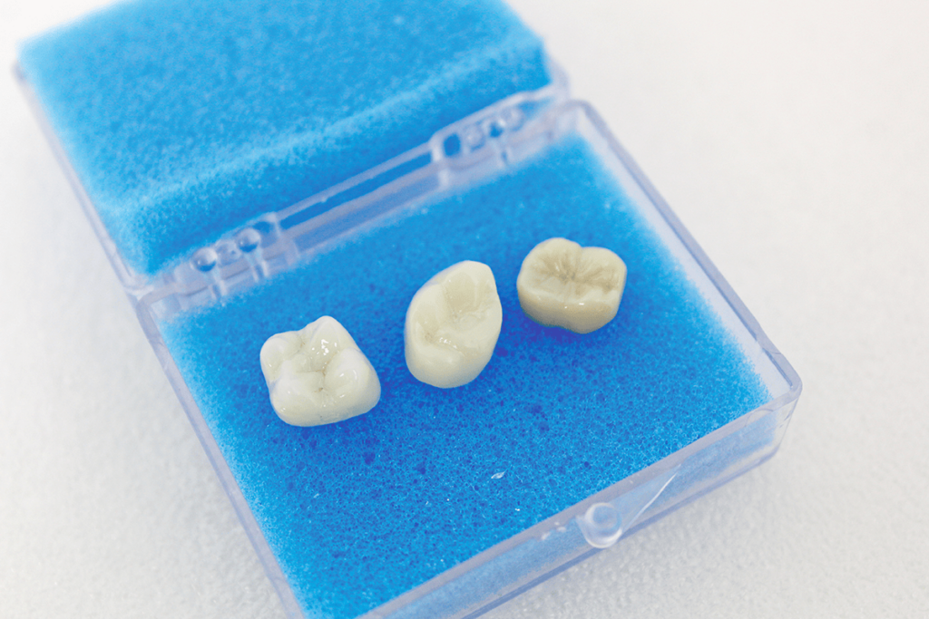 Full Service Crowns - Cooperative Dental Labs