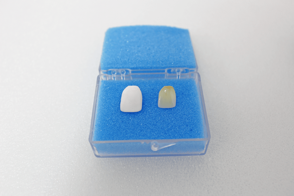 Two Caps - Cooperative Dental Labs